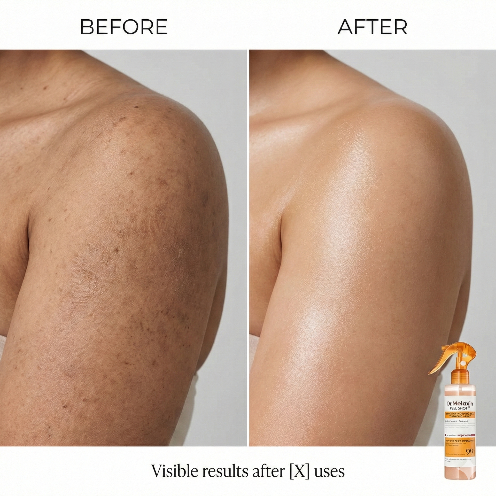 Dr. Melaxin | Body Exfoliating Treatment Spray